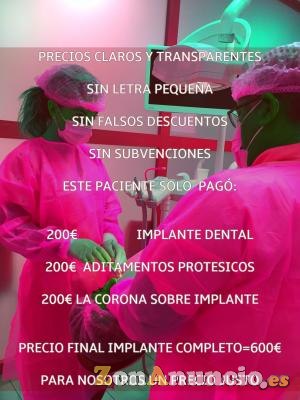 CLINICA DENTAL EN JEREZ OFERTA 200€ EL IMPLANTE DENTAL